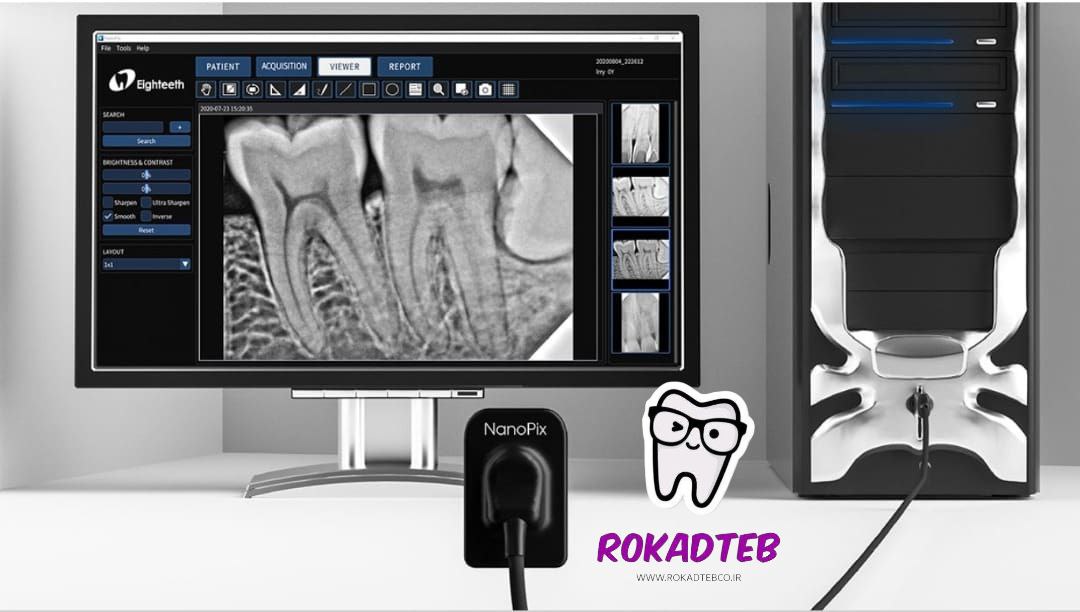 محیط نرم افزار ایتیس