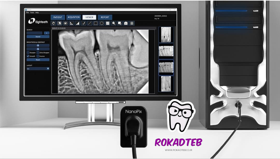 سنسور RVG ایتیس Eighteeth مدل Nanopix