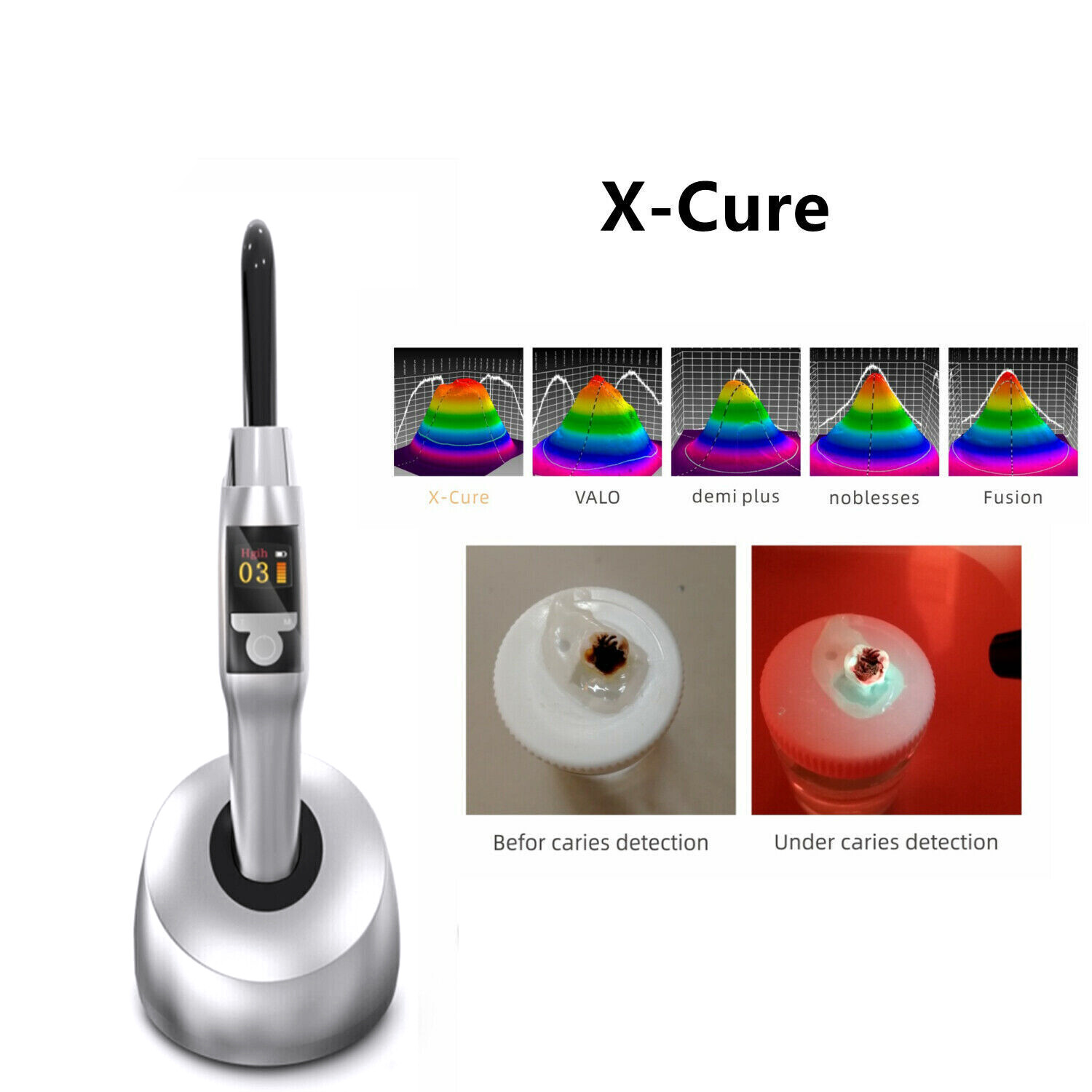 نمای کامل لایت کیور وودپکر X-Cure مناسب کیورینگ کامپوزیت در کلینیک دندانپزشکی