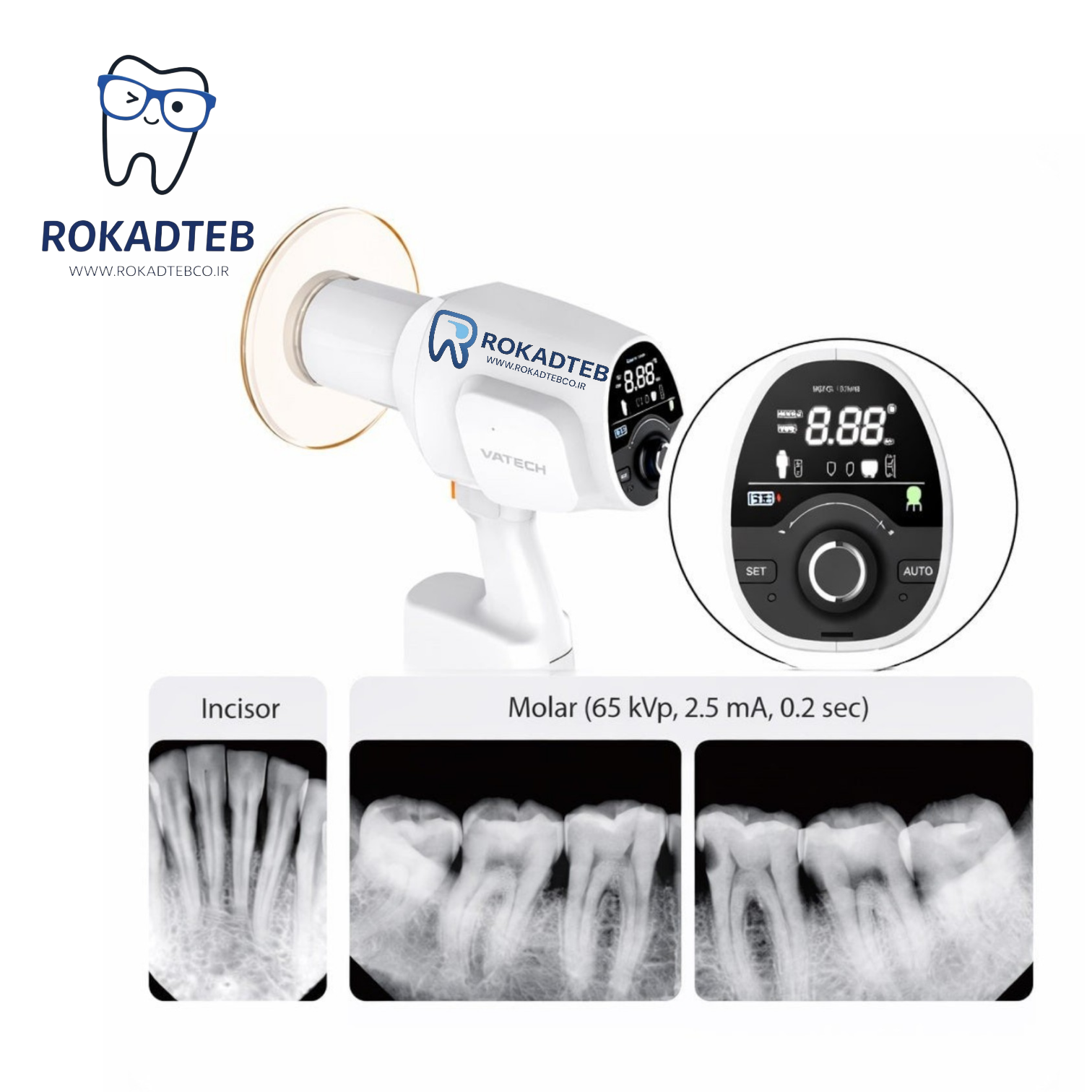 رادیوگرافی پرتابل دندانپزشکی Vatech EzRay-Air با طراحی سبک و ارگونومیک