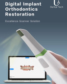 اسکنر داخل دهانی | قیمت +