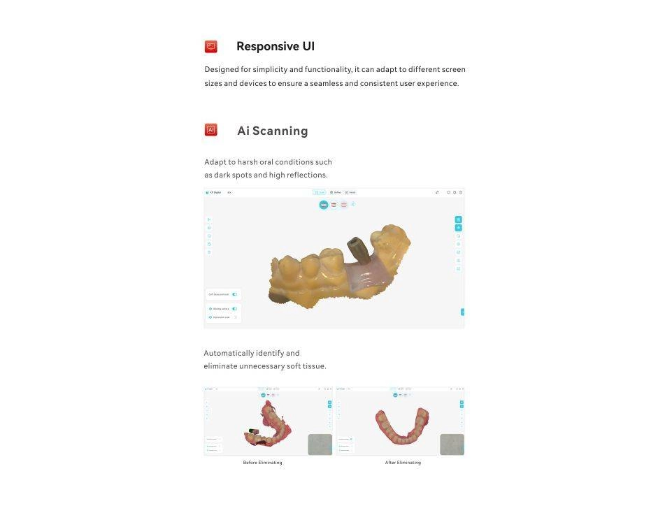 اسکنر داخل دهانی kevinpeter مدل smile scan