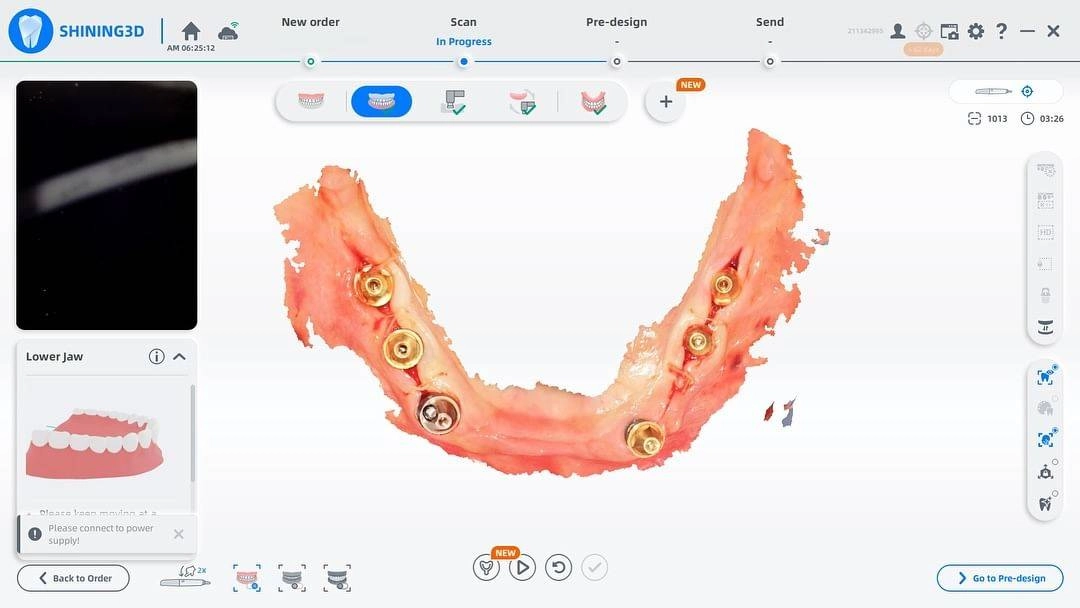 اسکنر داخل دهانی الیت شاینینگ | Aoralscan Elite |