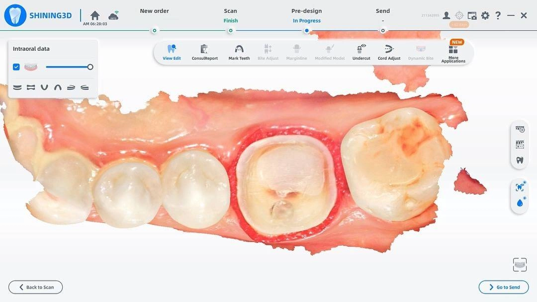 اسکنر داخل دهانی الیت شاینینگ | Aoralscan Elite |