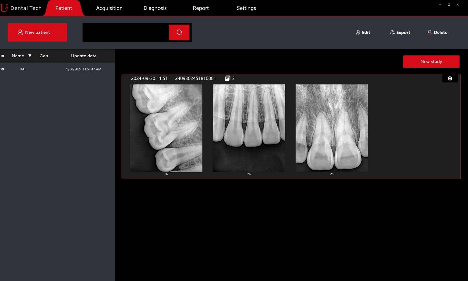 سنسور RVG یو ای دنتال ua dental مدل ua-sensor