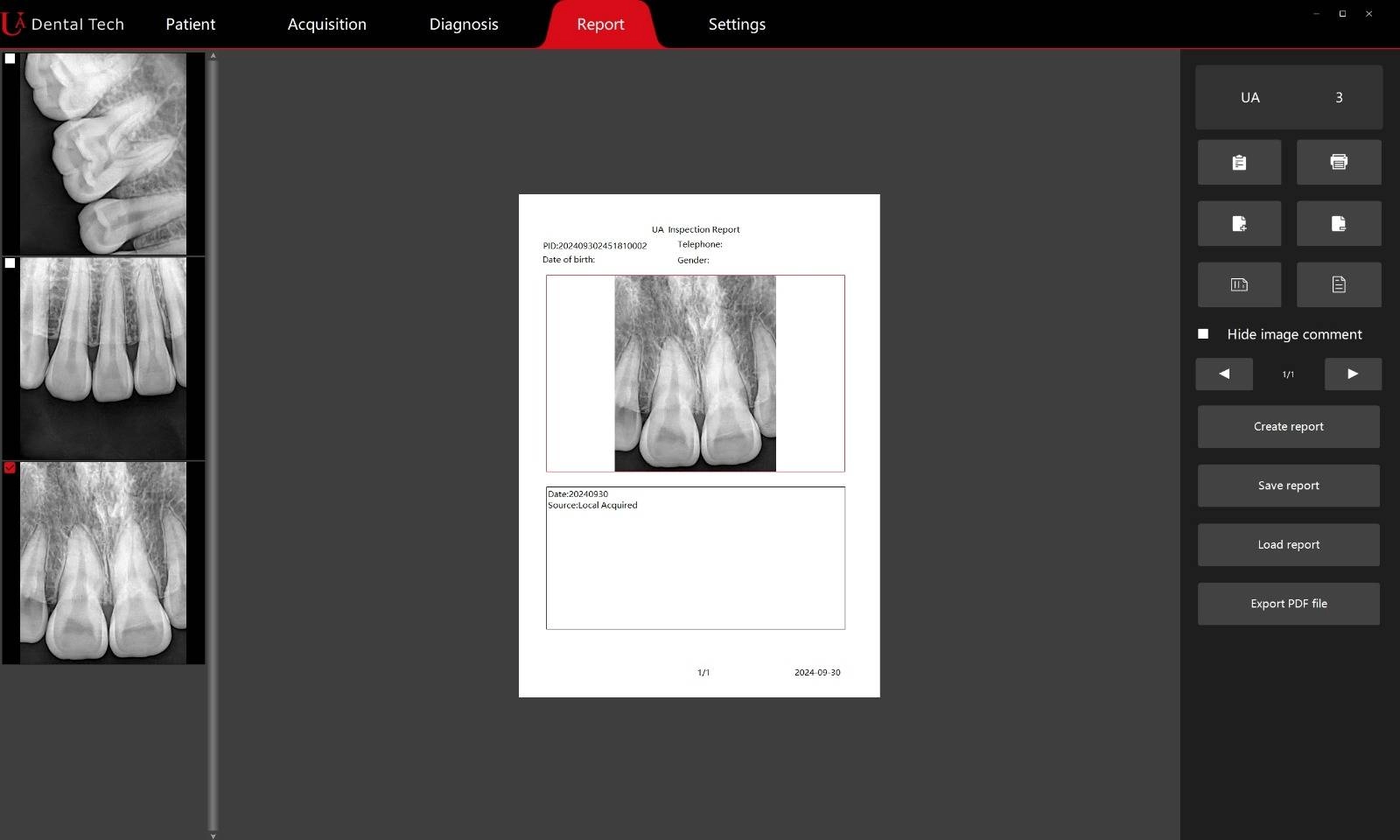 سنسور RVG یو ای دنتال ua dental مدل ua-sensor