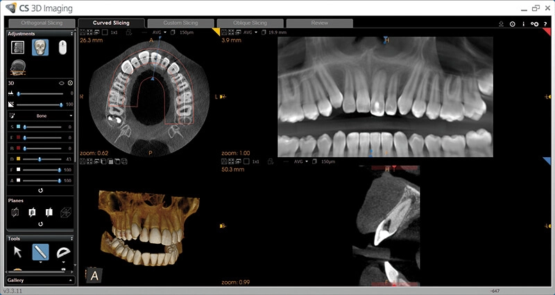 سی تی اسکن دندان کداک CBCT Carestream CS8100 EVO 3D