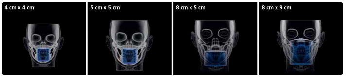 سی تی اسکن دندان کداک CBCT Carestream CS8100 EVO 3D