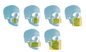 سی تی اسکن دندان کداک CBCT Carestream CS8200 3D