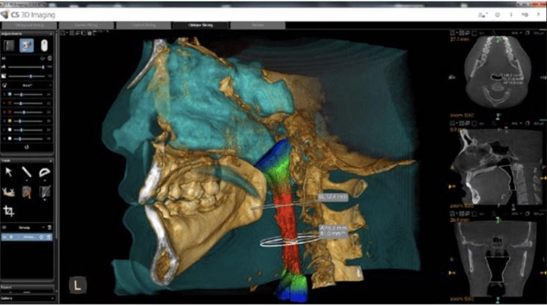 سی تی اسکن دندان کداک CBCT Carestream CS9600