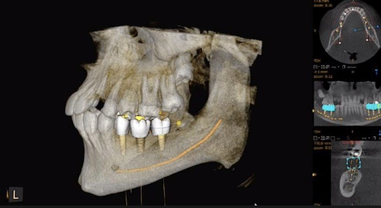 سی تی اسکن دندان کداک CBCT Carestream CS9600