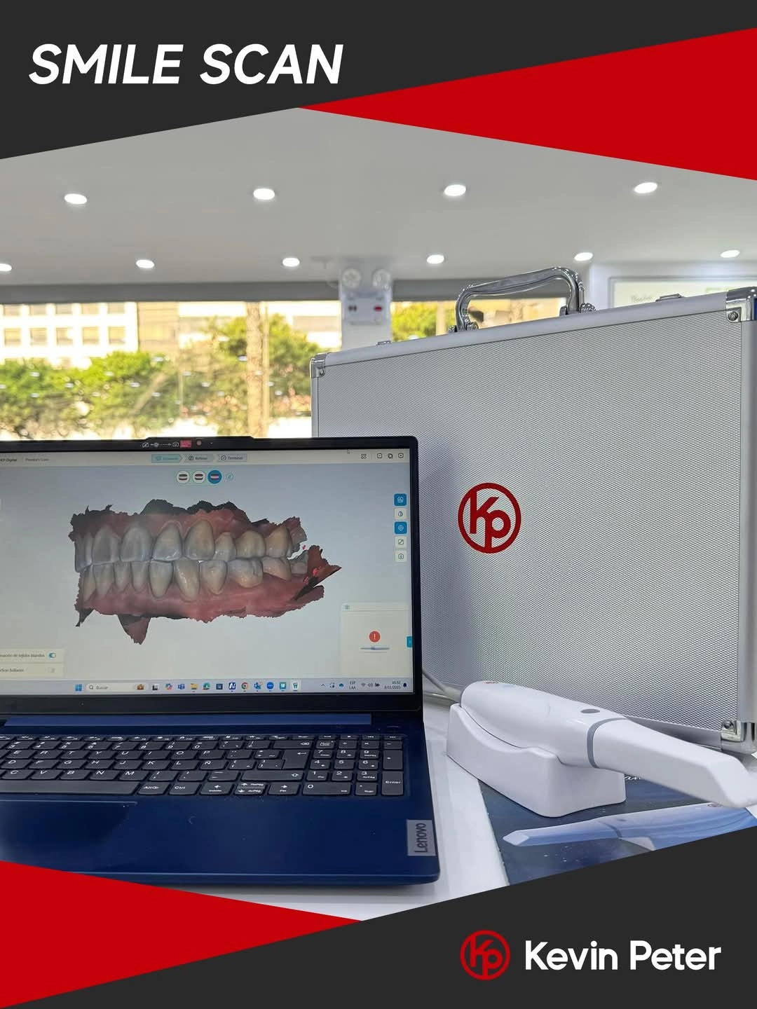 اسکنر داخل دهانی وودپکر KP مدل smile scan