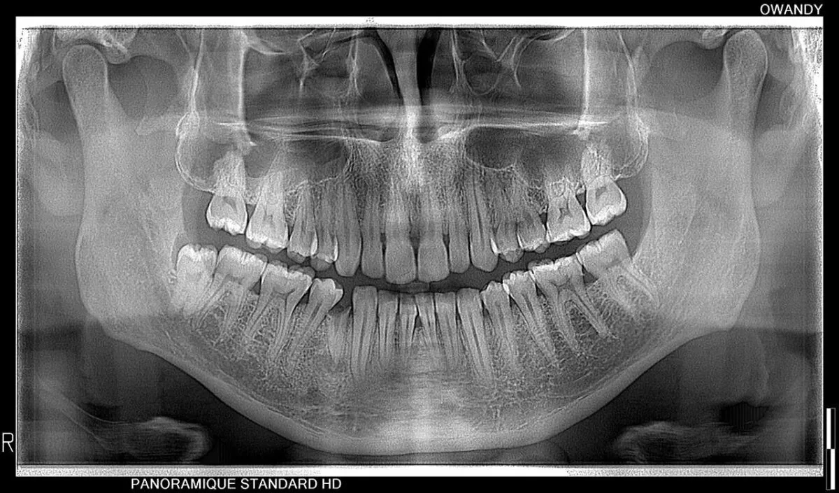رادیوگرافی OPG و CBCT اوندی OWANDY