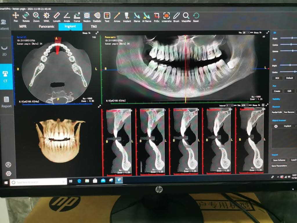 دستگاه CBCT مدل Smart 3DX برند largev