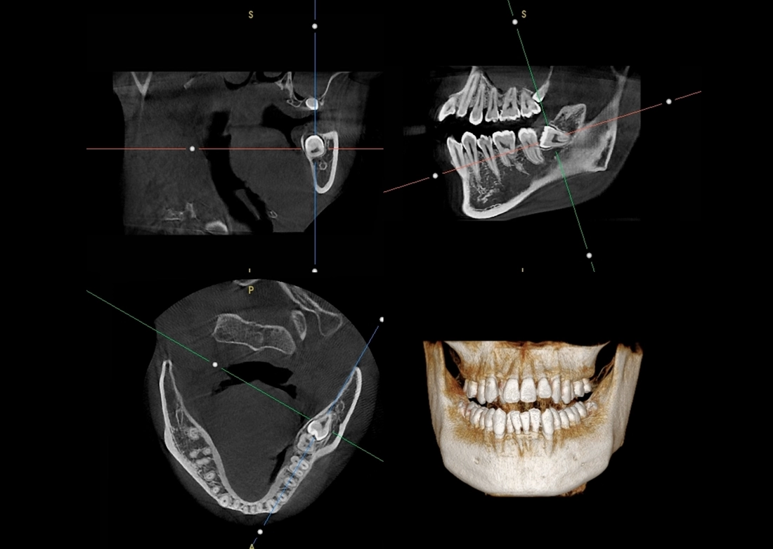 دستگاه پانورکس-CBCT دیجیتال مدل Papaya 3D