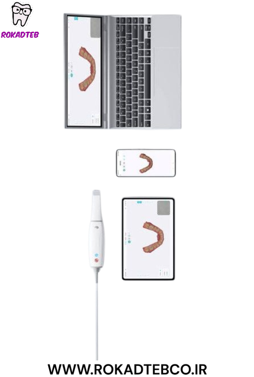 اسکنر داخل دهانی وودپکر KP مدل smile scan
