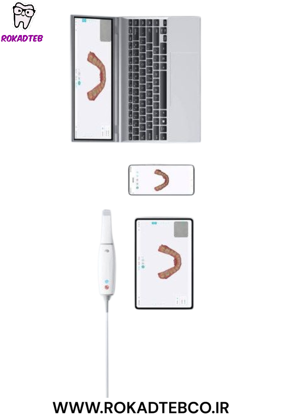 اسکنر داخل دهانی وودپکر KP مدل smile scan