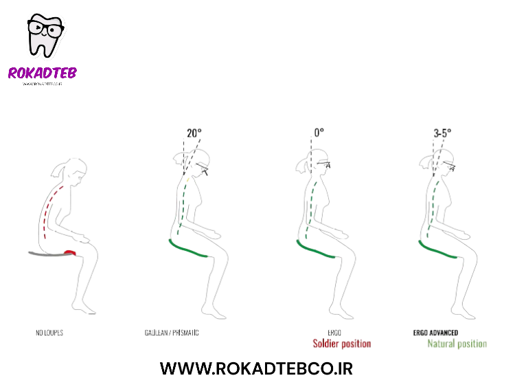 لوپ Univet مدل Ergo Advanced | رکادطب