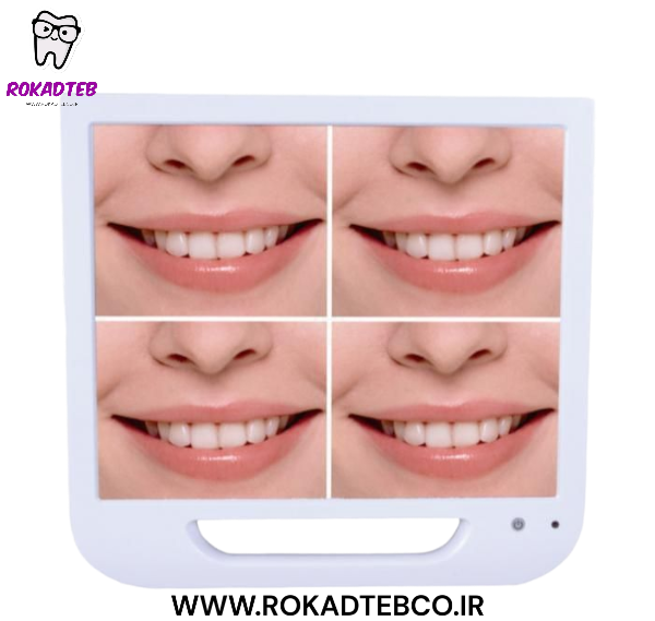 مانیتور و دوربین داخل دهانی FTZ | رکادطب