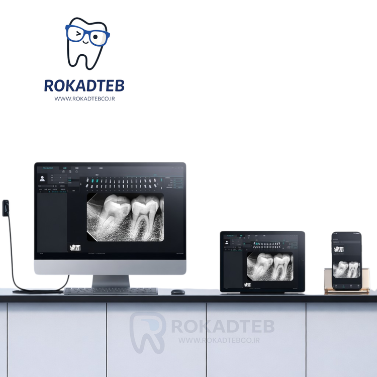 نمونه خروجی سنسور RVG دندانپزشکی Woodpecker I Sensor