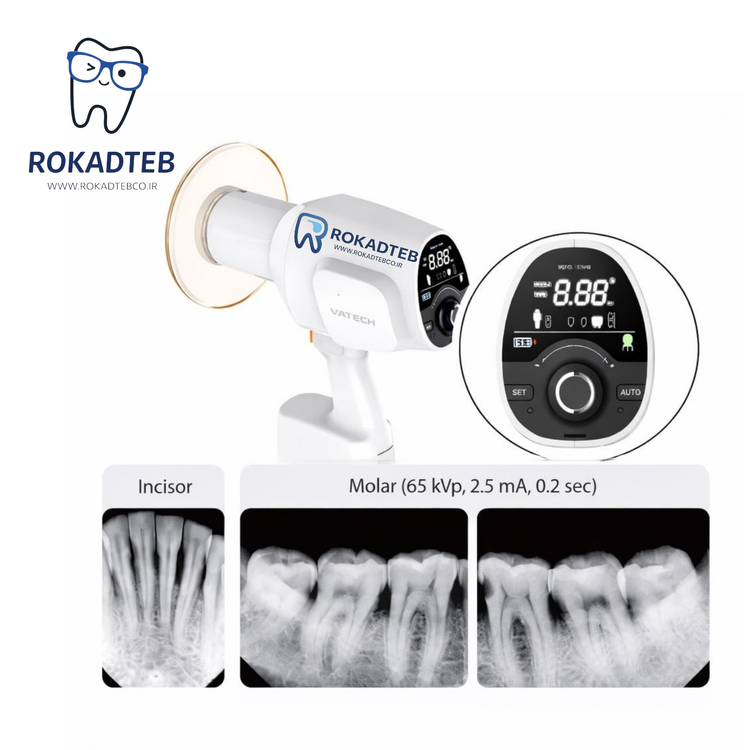 رادیوگرافی Handy واتک Vatech مدل EzRay-Air | رکادطب