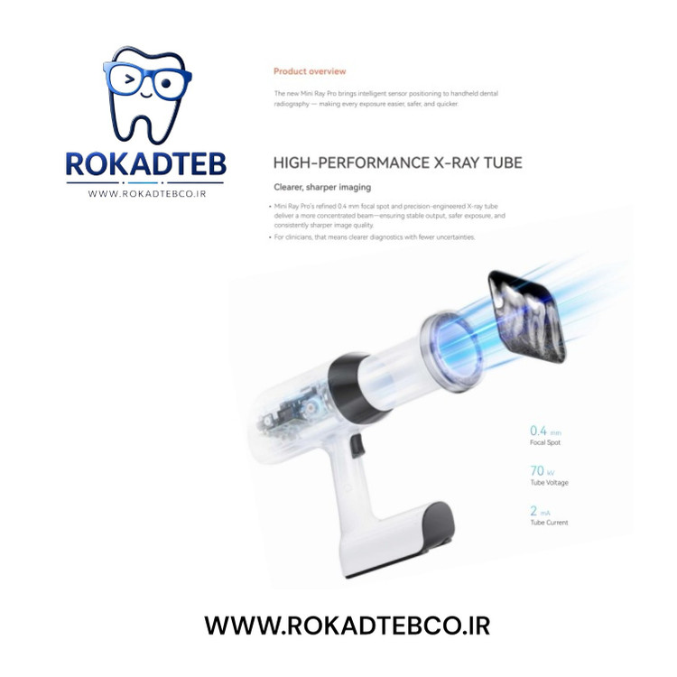 رادیوگرافی پرتابل وودپیکر Mini Ray Pro | تصویربرداری داخل دهانی رکادطب